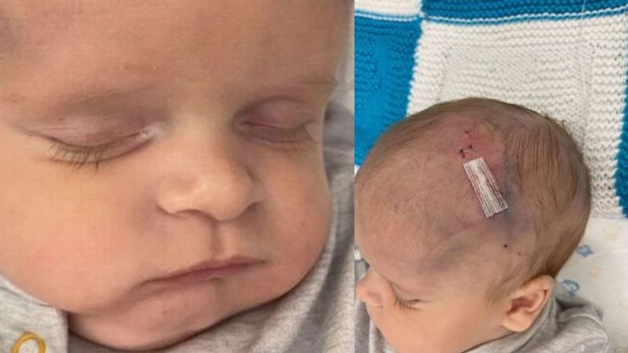 जन्म के वक्त डॉक्टर ने ऐसी कौन सी गलती की, जिसकी वजह से बच्चे का ब्रेन हो गया डैमेज जन्म के वक्त डॉक्टर ने ऐसी कौन सी गलती की, जिसकी वजह से बच्चे का ब्रेन हो गया डैमेज