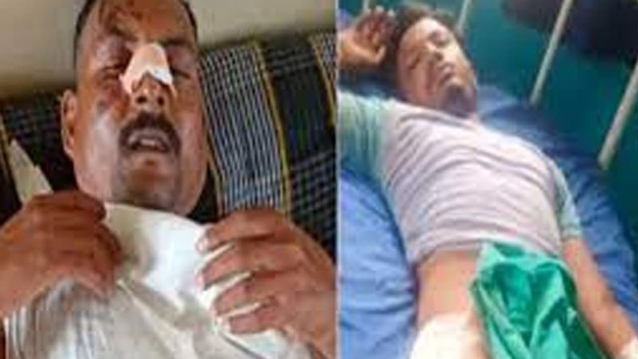 माफियाओं को नहीं किसी का डर: चेंकिग की तो कर्मचारियों पर चढ़ा दी स्कॉर्पियो, फिर भी नहीं रुके और.. माफियाओं को नहीं किसी का डर: चेंकिग की तो कर्मचारियों पर चढ़ा दी स्कॉर्पियो, फिर भी नहीं रुके और..