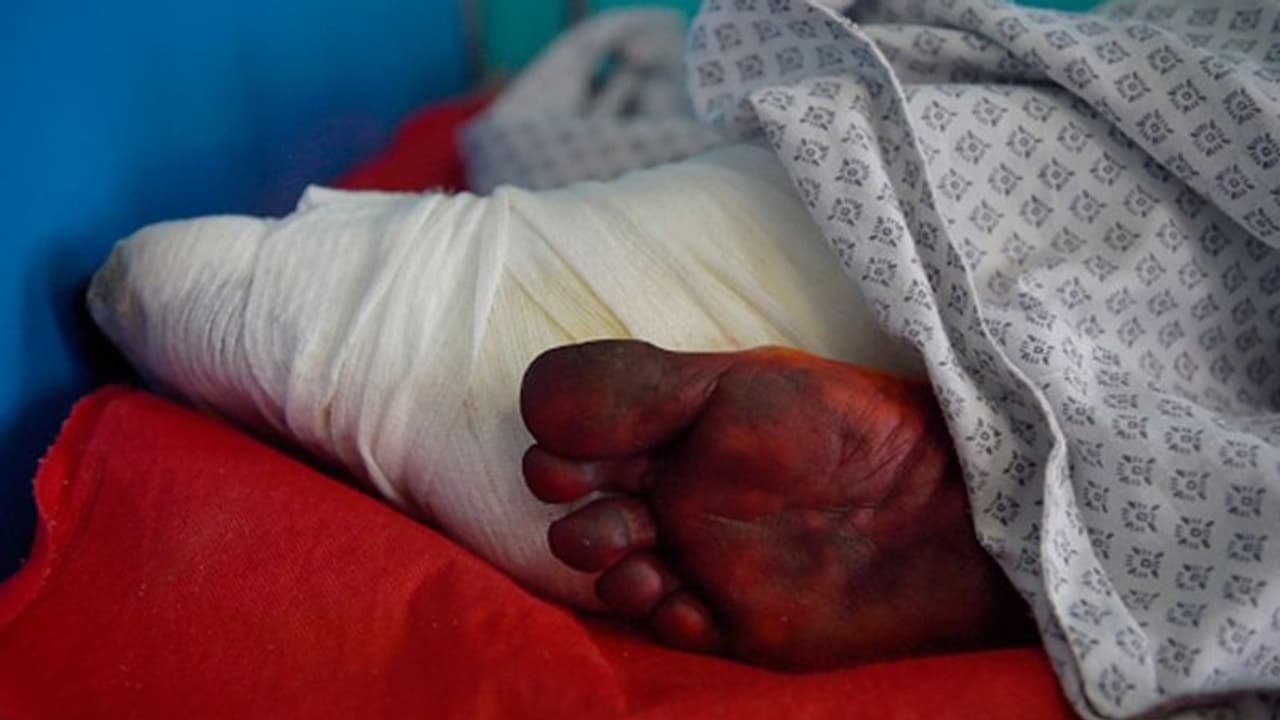 नेल पॉलिश लगाया तो ऊंगली काट दी, जीन्स पहनने पर गर्दन पर कोड़े मारे..तालिबान की दिल दहला देने वाले कहानी नेल पॉलिश लगाया तो ऊंगली काट दी, जीन्स पहनने पर गर्दन पर कोड़े मारे..तालिबान की दिल दहला देने वाले कहानी