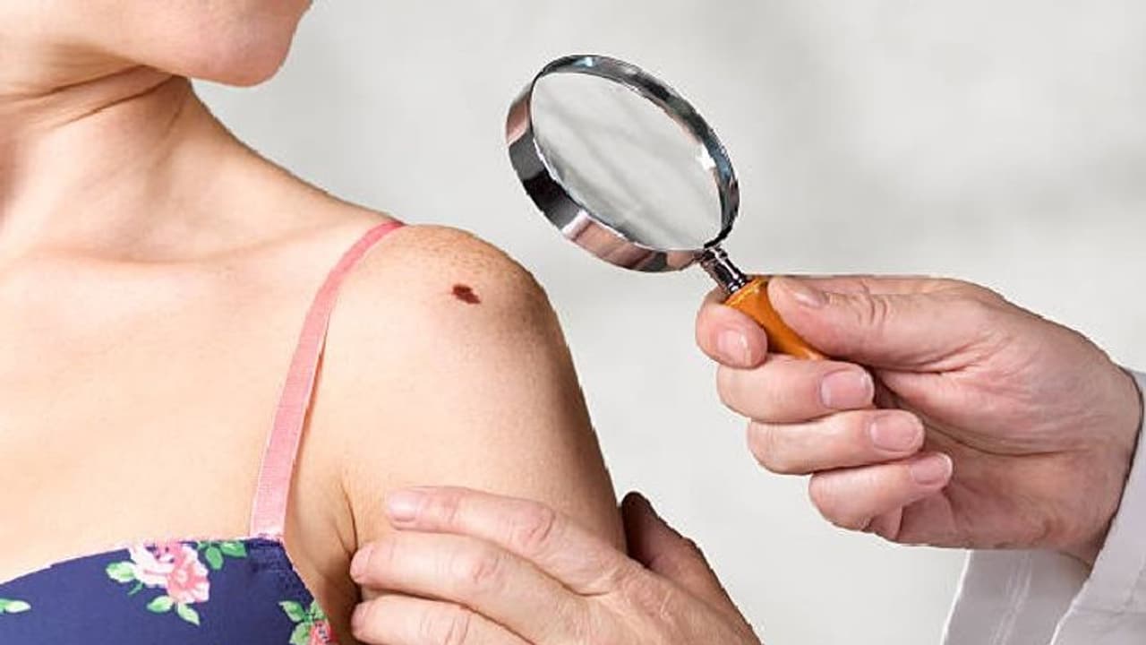 শরীরের এই অংশগুলিতে তিল থাকলে বিপদ আসতে পারে, জেনে নিন বিস্তারিত শরীরের এই অংশগুলিতে তিল থাকলে বিপদ আসতে পারে, জেনে নিন বিস্তারিত