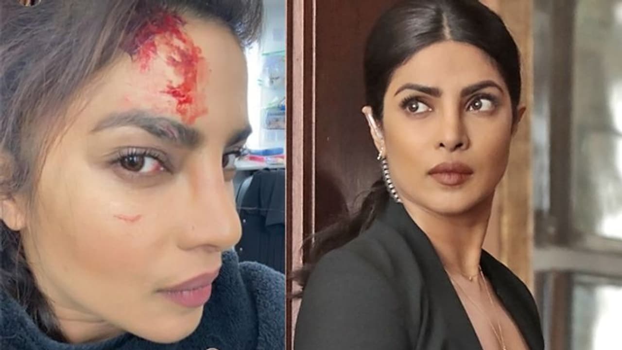 लहूलुहान हुईं प्रियंका चोपड़ा, एक्ट्रेस ने दो तस्वीरें शेयर करके दिखाया फेक और रियल जख्म लहूलुहान हुईं प्रियंका चोपड़ा, एक्ट्रेस ने दो तस्वीरें शेयर करके दिखाया फेक और रियल जख्म