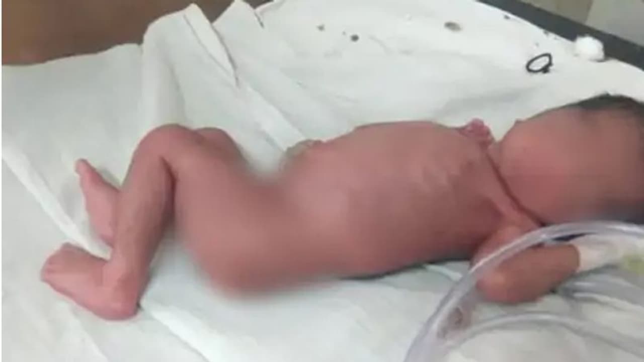 इंसानियत शर्मसार: पत्थर दिल मां बाप जन्म के बाद बच्ची को सड़क पर फेंक गए, ऊपर चींटियां खड़े थे कुत्ते इंसानियत शर्मसार: पत्थर दिल मां बाप जन्म के बाद बच्ची को सड़क पर फेंक गए, ऊपर चींटियां खड़े थे कुत्ते