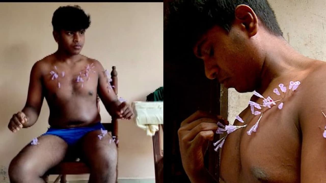 30 സെക്കന്റ്, 110 സൂചി; ശരീരത്തിൽ സൂചി കുത്തി റെക്കോർഡുമായി യുവാവ് 30 സെക്കന്റ്, 110 സൂചി; ശരീരത്തിൽ സൂചി കുത്തി റെക്കോർഡുമായി യുവാവ്