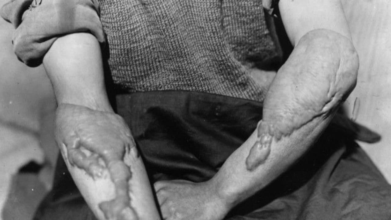 ഉറുമ്പിനെ പോലെ നടക്കുന്ന മുതല മനുഷ്യര്; വെറുതെയല്ല അവര് അങ്ങനെയായത്! ഉറുമ്പിനെ പോലെ നടക്കുന്ന മുതല മനുഷ്യര്; വെറുതെയല്ല അവര് അങ്ങനെയായത്!