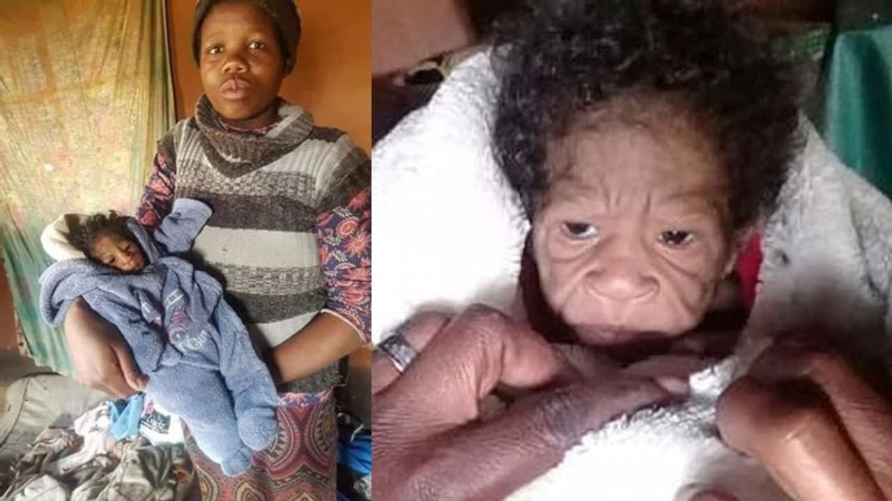 Shocking: ये कोई बुजुर्ग महिला नहीं बल्कि नवजात बच्ची है, चौंकाने वाली है इसके पीछे की कहानी Shocking: ये कोई बुजुर्ग महिला नहीं बल्कि नवजात बच्ची है, चौंकाने वाली है इसके पीछे की कहानी