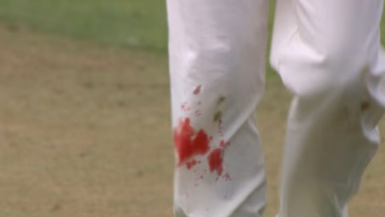 #ENGvsIND 39 வயதில் ரத்தம் சொட்டச்சொட்ட விளையாடிய ஆண்டர்சன்..! வியக்கவைக்கும் ஆண்டர்சனின் அர்ப்பணிப்பு #ENGvsIND 39 வயதில் ரத்தம் சொட்டச்சொட்ட விளையாடிய ஆண்டர்சன்..! வியக்கவைக்கும் ஆண்டர்சனின் அர்ப்பணிப்பு