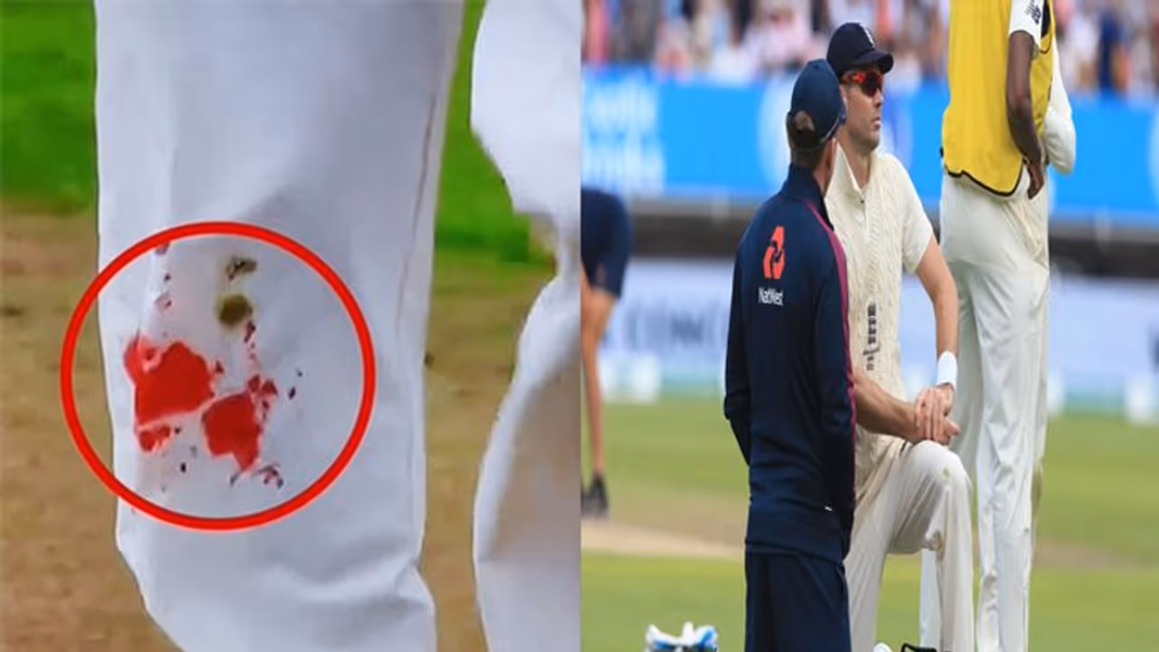 घुटने से बहता रहा खून, लेकिन फिर भी मैदान पर डटा रहा ये खिलाड़ी, फैंस ने किया जज्बे को सलाम घुटने से बहता रहा खून, लेकिन फिर भी मैदान पर डटा रहा ये खिलाड़ी, फैंस ने किया जज्बे को सलाम