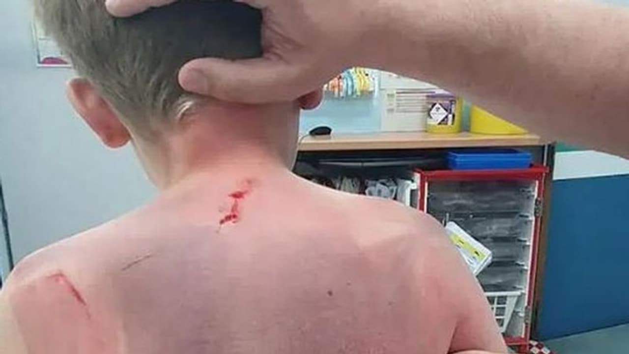 बाथ टब का इस्तेमाल करने वाले हो जाए सावधान, एक मां ने बताया कैसे उसका बेटा मौत के मुंह से वापस आया बाथ टब का इस्तेमाल करने वाले हो जाए सावधान, एक मां ने बताया कैसे उसका बेटा मौत के मुंह से वापस आया