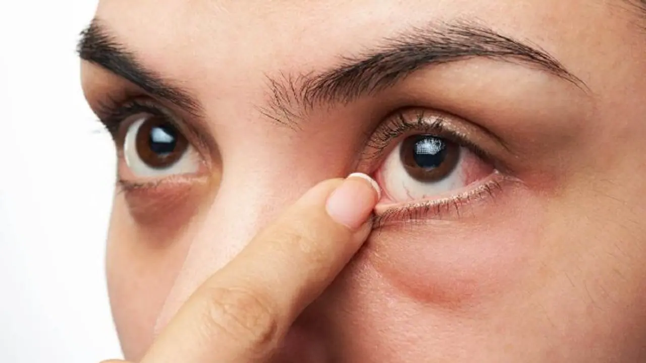 'കണ്ണിനെ ബാധിക്കുന്ന ചില അസുഖങ്ങള്‍ പിന്നീടുണ്ടാക്കുന്ന പ്രശ്‌നം'