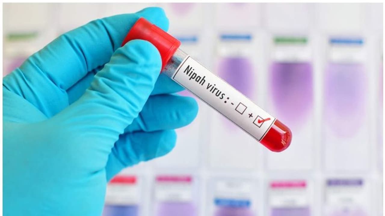 നിപ വൈറസ്; സ്വീകരിക്കേണ്ട മുന്‍കരുതലുകള്‍ എന്തൊക്കെ...?