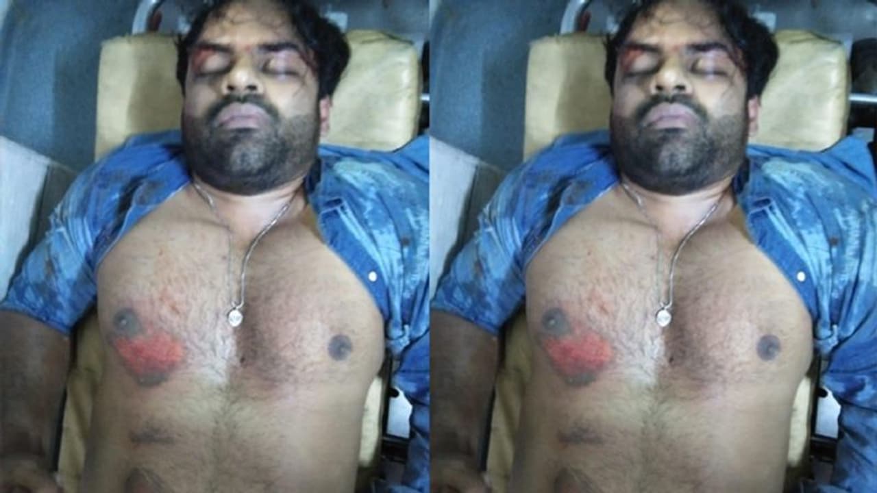 హైదరాబాద్: మాదాపూర్ కేబుల్ బ్రిడ్జిపై ప్రమాదం.. హీరో సాయిధరమ్ తేజ్‌కు తీవ్రగాయాలు