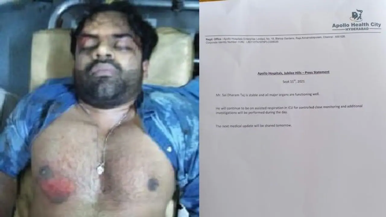 అపోలో వైద్యుల లేటెస్ట్ బులెటిన్: నిలకడగా సాయి ధరమ్ హెల్త్ కండిషన్.. ఐసీయూలోనే చికిత్స! అపోలో వైద్యుల లేటెస్ట్ బులెటిన్: నిలకడగా సాయి ధరమ్ హెల్త్ కండిషన్.. ఐసీయూలోనే చికిత్స!