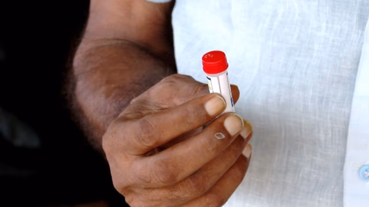 അട്ടപ്പാടി ഈരുകളിൽ അനധികൃതമായി ഹോമിയോ മരുന്ന് വിതരണം, ആധാർ രേഖകൾ ശേഖരിക്കുന്നതായും പരാതി അട്ടപ്പാടി ഈരുകളിൽ അനധികൃതമായി ഹോമിയോ മരുന്ന് വിതരണം, ആധാർ രേഖകൾ ശേഖരിക്കുന്നതായും പരാതി