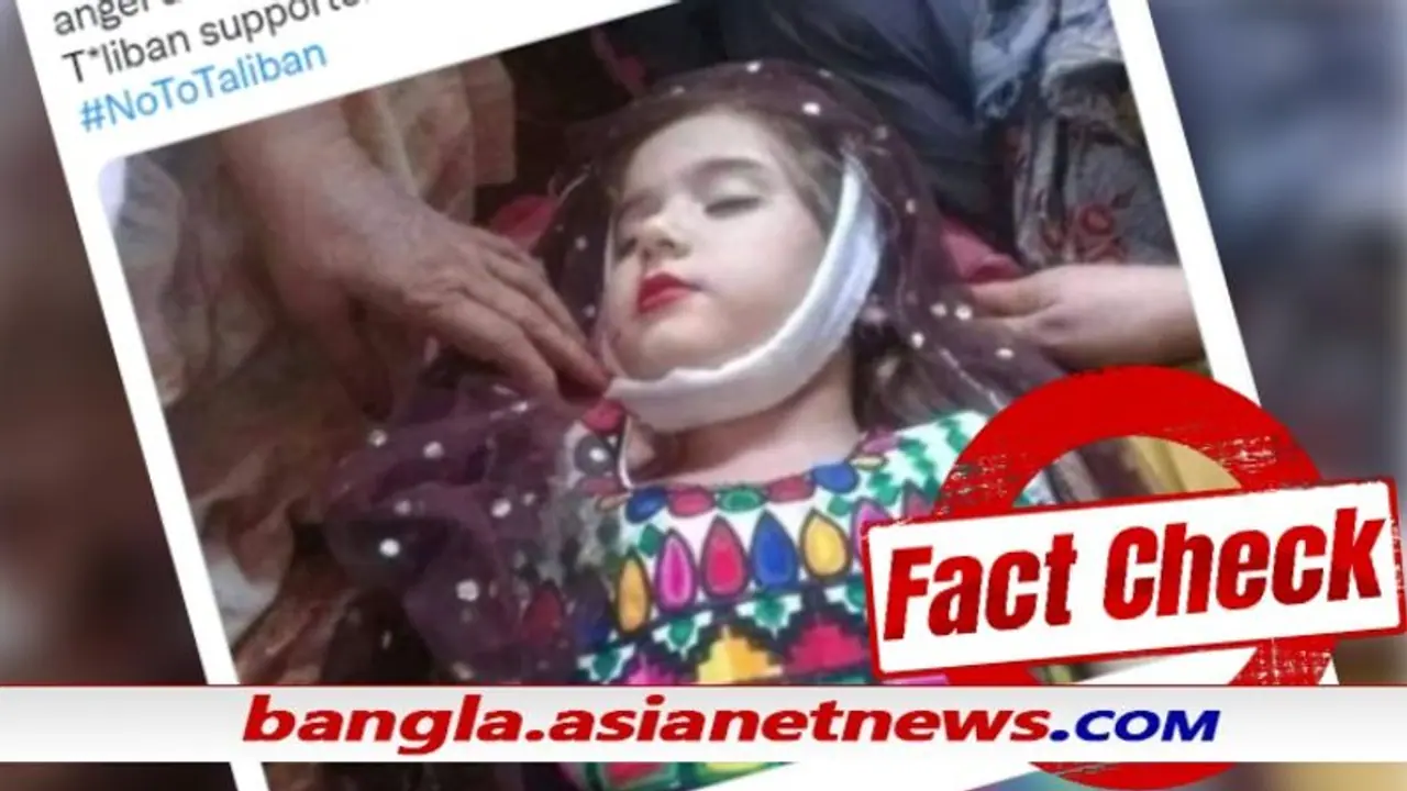 Fact Check এই ফুটফুটে মেয়েটিও কি তালিবানি অত্যাচারের শিকার, কী দোষ ছিল তার Fact Check এই ফুটফুটে মেয়েটিও কি তালিবানি অত্যাচারের শিকার, কী দোষ ছিল তার