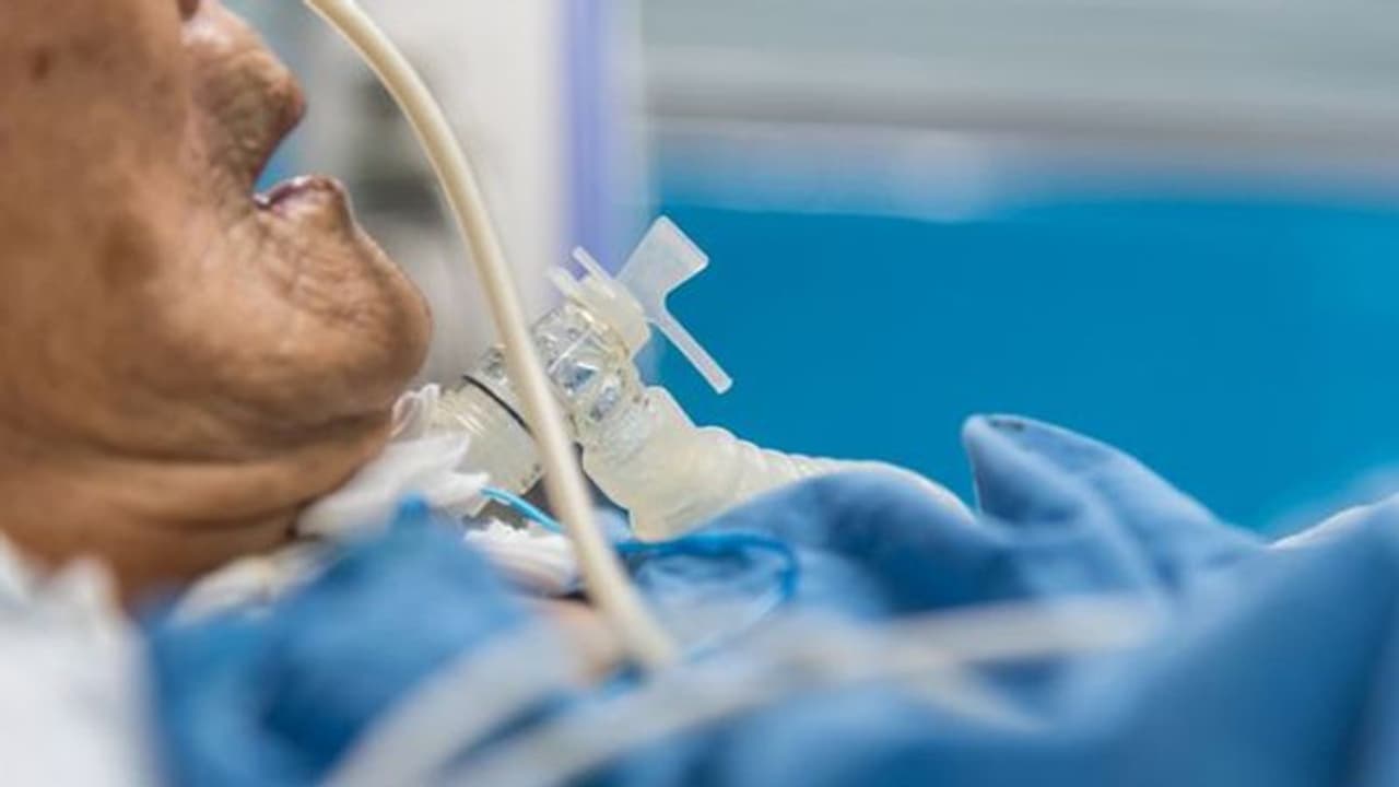 ಅಮೆರಿಕದಲ್ಲಿ 7 ಲಕ್ಷ ಜನರ ಸಾವು, 4.4 ಕೋಟಿ ಜನರಿಗೆ ಸೋಂಕು!