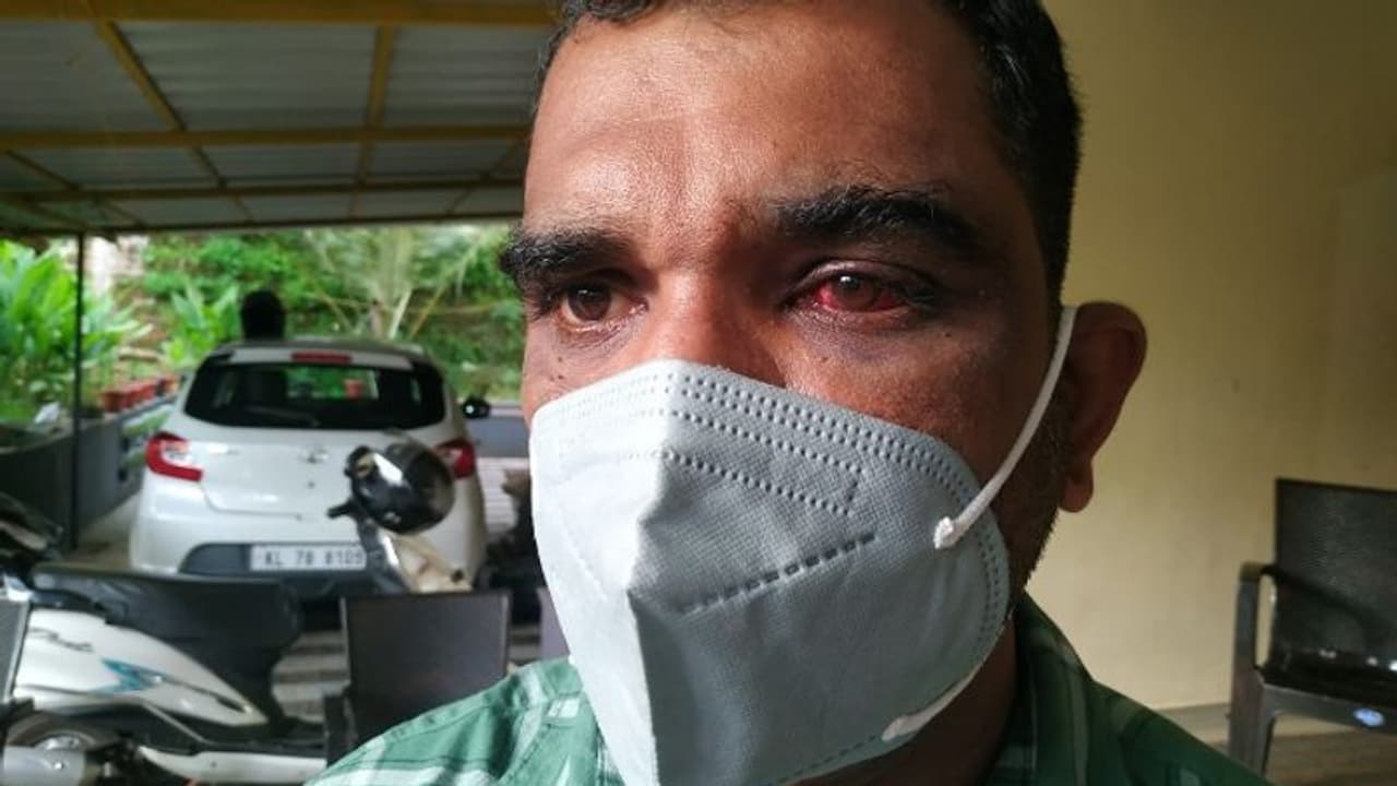 അതിഥി തൊഴിലാളിയെ മർദ്ദിക്കുന്നത് ചോദ്യം ചെയ്ത വിമുക്ത ഭടനെ സിപിഎം പ്രവർത്തകർ മർദ്ദിച്ചെന്ന് പരാതി അതിഥി തൊഴിലാളിയെ മർദ്ദിക്കുന്നത് ചോദ്യം ചെയ്ത വിമുക്ത ഭടനെ സിപിഎം പ്രവർത്തകർ മർദ്ദിച്ചെന്ന് പരാതി