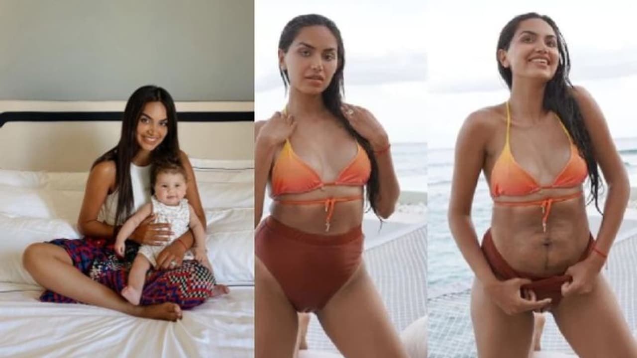 ഈ മാറ്റങ്ങൾ സ്വാഭാവികം; പ്രസവത്തിന് മുമ്പും ശേഷവുമുള്ള ചിത്രങ്ങൾ പങ്കുവച്ച് യുവതി