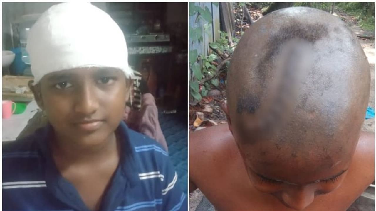 'പൊട്ടിയ തലയുടെ ഭാഗത്ത് മുടിയും കൂട്ടി സ്റ്റാപ്ലർ പിൻ അടിച്ചു'; ആലപ്പുഴ മെഡിക്കൽ കോളേിനെതിരെ പരാതി 'പൊട്ടിയ തലയുടെ ഭാഗത്ത് മുടിയും കൂട്ടി സ്റ്റാപ്ലർ പിൻ അടിച്ചു'; ആലപ്പുഴ മെഡിക്കൽ കോളേിനെതിരെ പരാതി