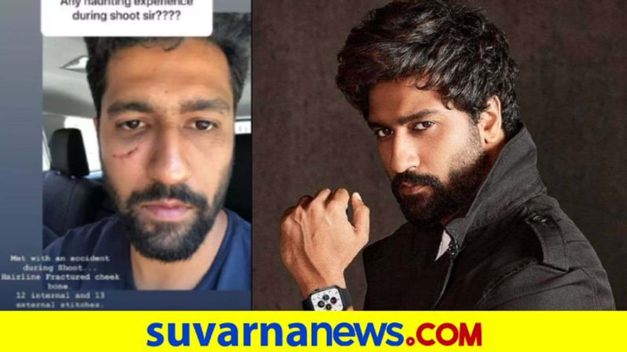 ಶೂಟಿಂಗ್ ವೇಳೆ ಗಾಯ: ಕತ್ರೀನಾ ಬಾಯ್ಫ್ರೆಂಡ್ ಗಲ್ಲದಲ್ಲಿ 25 ಸ್ಟಿಚ್ ಶೂಟಿಂಗ್ ವೇಳೆ ಗಾಯ: ಕತ್ರೀನಾ ಬಾಯ್ಫ್ರೆಂಡ್ ಗಲ್ಲದಲ್ಲಿ 25 ಸ್ಟಿಚ್