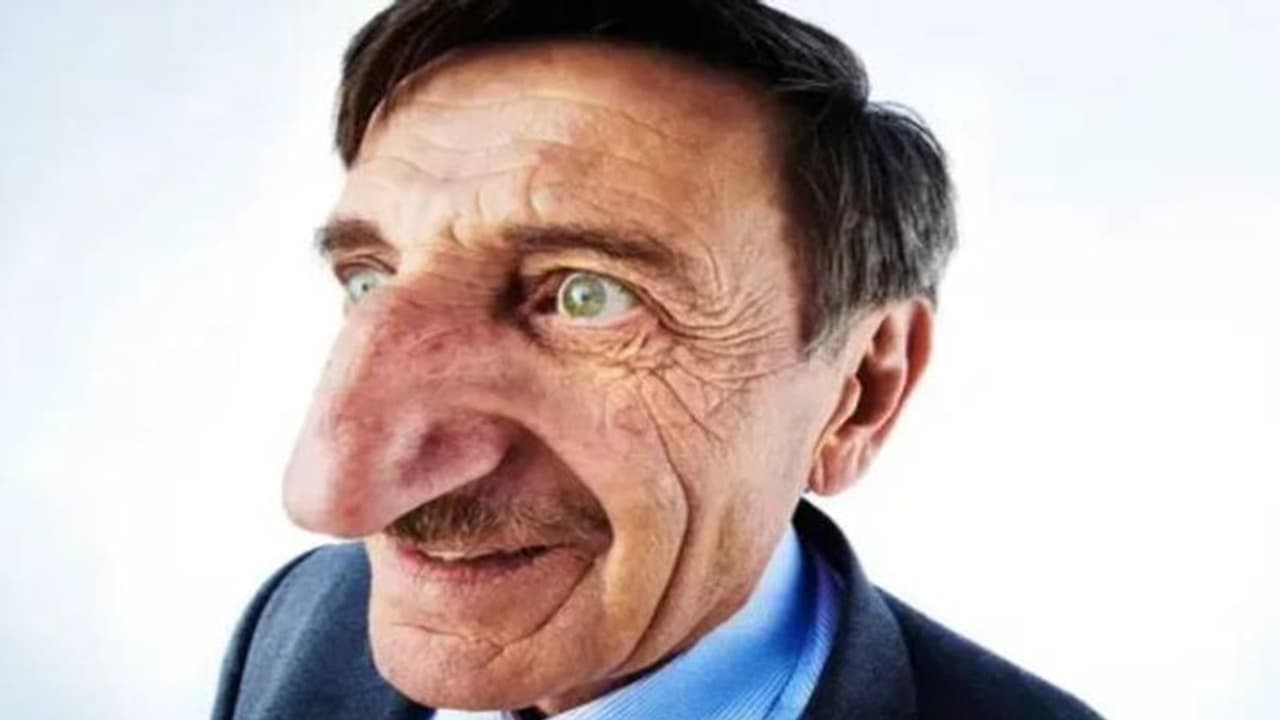 ലോകത്തിലെ ഏറ്റവും നീളമുള്ള മൂക്ക് ഇതാണോ? ലോകറെക്കോഡുമായി ടർക്കിഷ് പൗരൻ