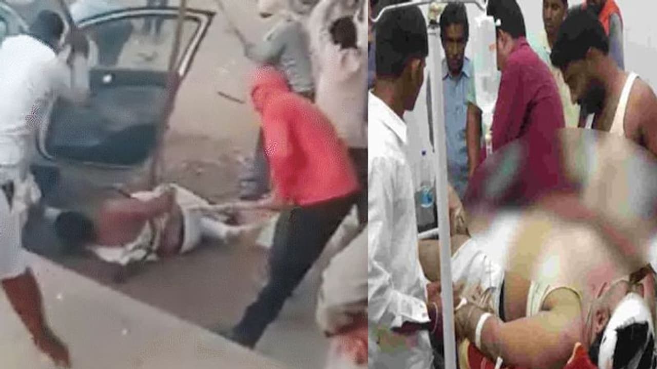 कांग्रेस नेता को सड़क पर गिराया और बेदम होने तक पीटा, 10 फ्रैक्चर आए, दोनों पैर टूटे, बिलखता रहा परिवार कांग्रेस नेता को सड़क पर गिराया और बेदम होने तक पीटा, 10 फ्रैक्चर आए, दोनों पैर टूटे, बिलखता रहा परिवार