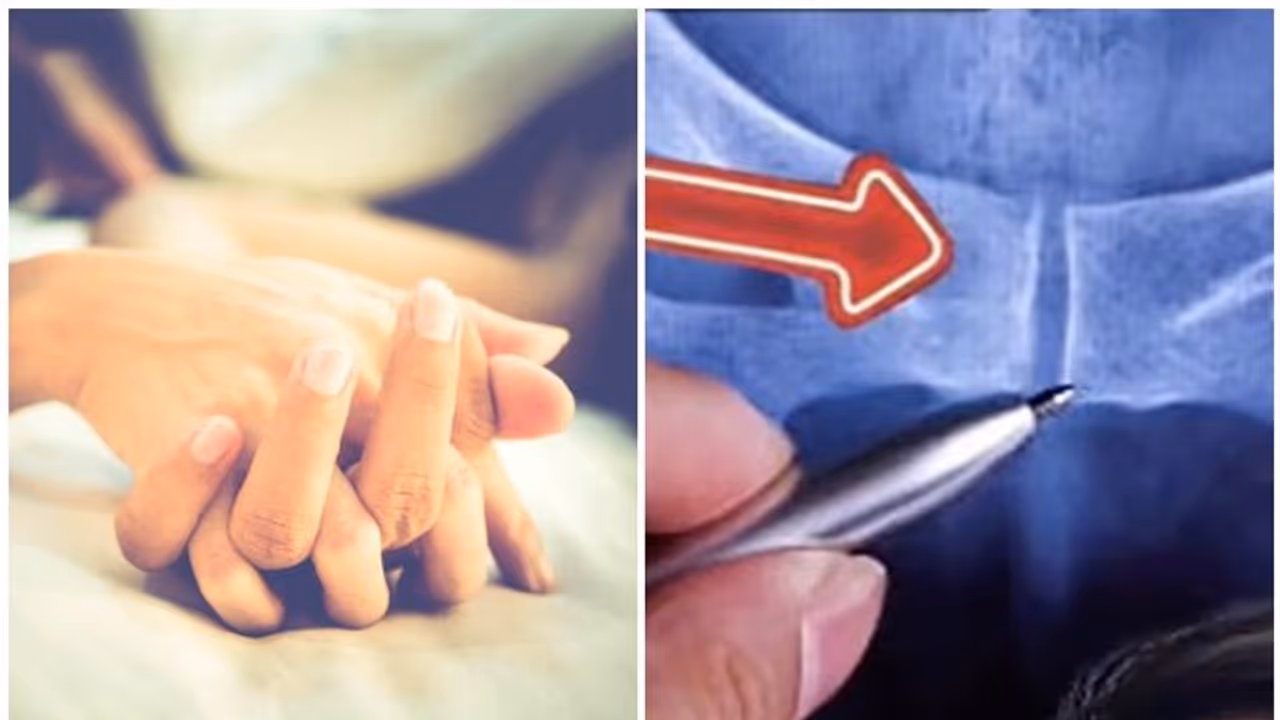 സെക്‌സിനിടെ ലിംഗം ഒടിഞ്ഞുപോവുന്ന അപകടങ്ങളിൽ പാതിക്കും കാരണം ഈ 'അപകടകരമായ' പൊസിഷൻ