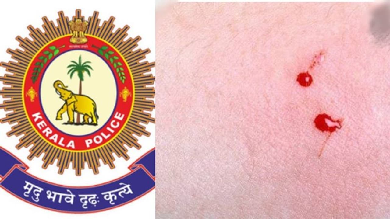 പാമ്പുകടിയേറ്റ യുവതിയെ ആശുപത്രിയിലെത്തിച്ച് രക്ഷകരായി പൊലീസ് പാമ്പുകടിയേറ്റ യുവതിയെ ആശുപത്രിയിലെത്തിച്ച് രക്ഷകരായി പൊലീസ്