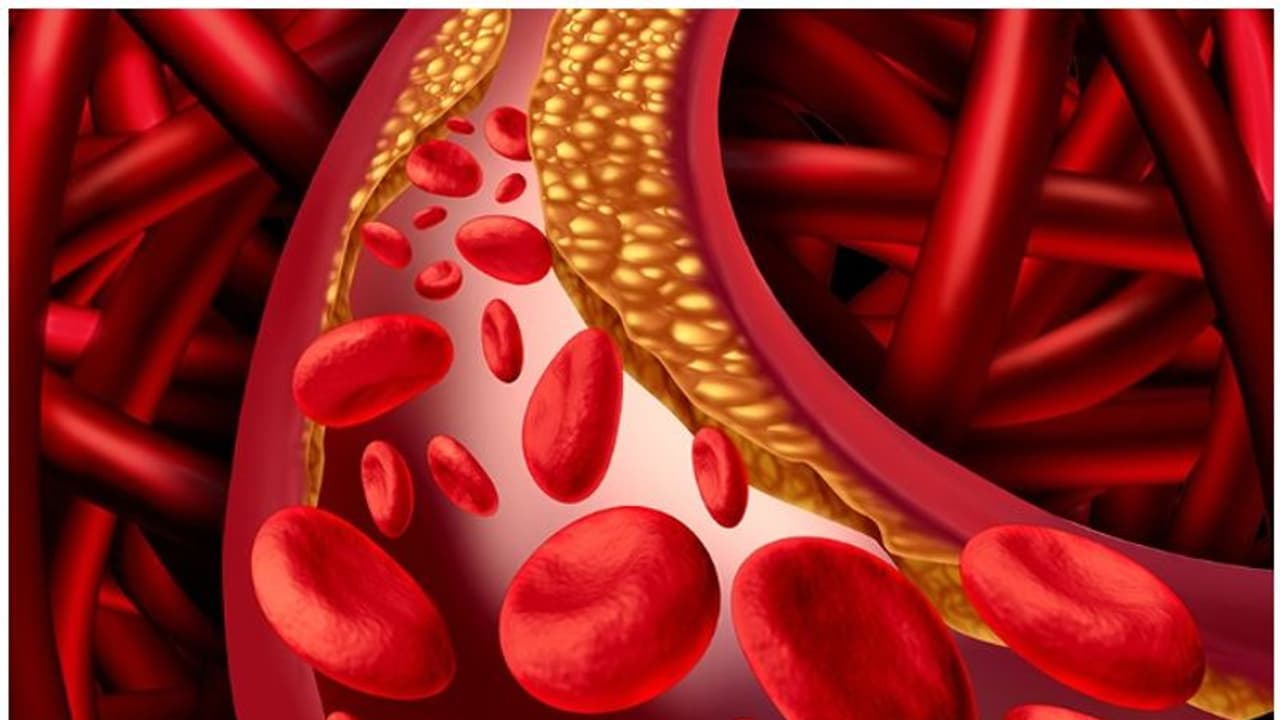 Control Cholesterol : ഉയര്‍ന്ന കൊളസ്ട്രോള്‍ നിയന്ത്രിക്കാന്‍ സഹായിക്കുന്ന മികച്ച അഞ്ച് ഭക്ഷണങ്ങളിതാ...
