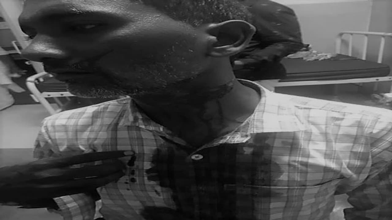 పెద్దపల్లి: పదిరూపాయల సిగరెట్ కోసం... గొడుగుతో గొంతులో పొడిచి హత్యాయత్నం (వీడియో) పెద్దపల్లి: పదిరూపాయల సిగరెట్ కోసం... గొడుగుతో గొంతులో పొడిచి హత్యాయత్నం (వీడియో)