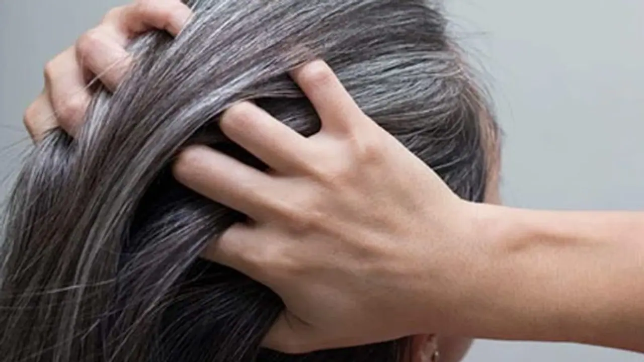 white hair white hair