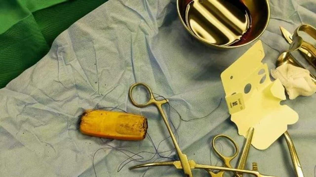 இப்படியும் ஒரு மனுசனா..? செல்போனை முழுங்கிய இளைஞர்… கடைசியில் டுவிஸ்ட் இப்படியும் ஒரு மனுசனா..? செல்போனை முழுங்கிய இளைஞர்… கடைசியில் டுவிஸ்ட்