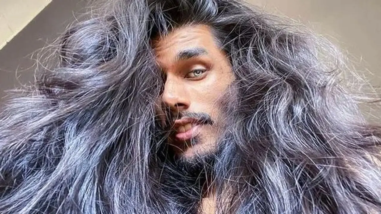 बालों की कीमत समझने वाला इंसान! गंजा हो चुका था, लेकिन जब दोबारा उगे तो खाई सबसे बड़ी कसम, आप भी सीख सकते हैं