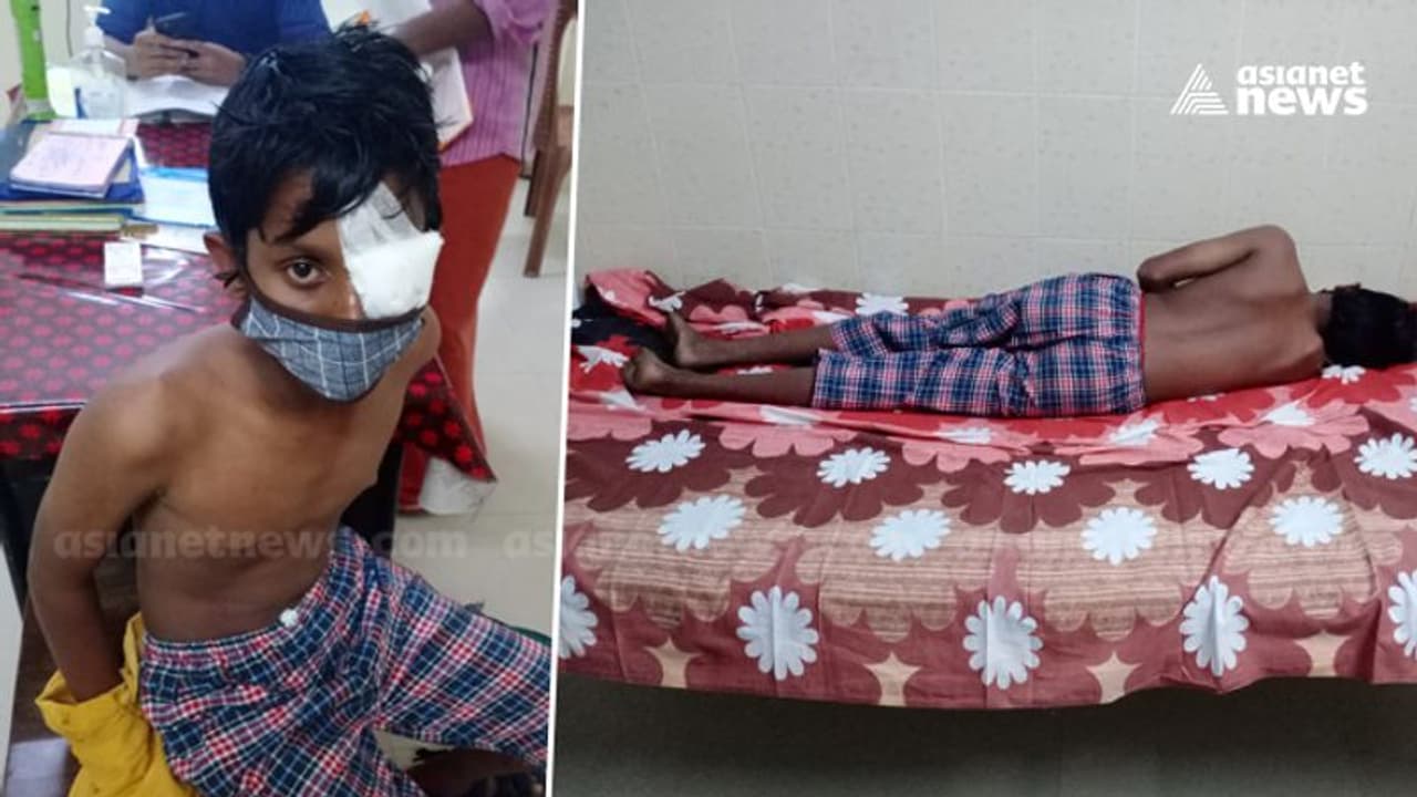 പത്താംക്ലാസുകാരന് അയൽവാസിയുടെ ക്രൂരമർദ്ദനം; കുട്ടിയുടെ കണ്ണിന് ഗുരുതര പരിക്ക്