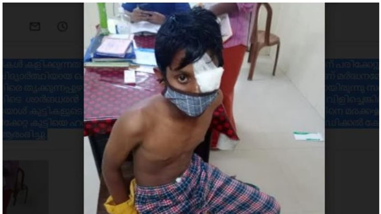പത്താം ക്ലാസ് വിദ്യാര്ത്ഥിക്ക് അയല്ക്കാരന്റെ ക്രൂരമര്ദ്ദനം; കണ്ണിന് ഗുരുതര പരിക്ക് പത്താം ക്ലാസ് വിദ്യാര്ത്ഥിക്ക് അയല്ക്കാരന്റെ ക്രൂരമര്ദ്ദനം; കണ്ണിന് ഗുരുതര പരിക്ക്