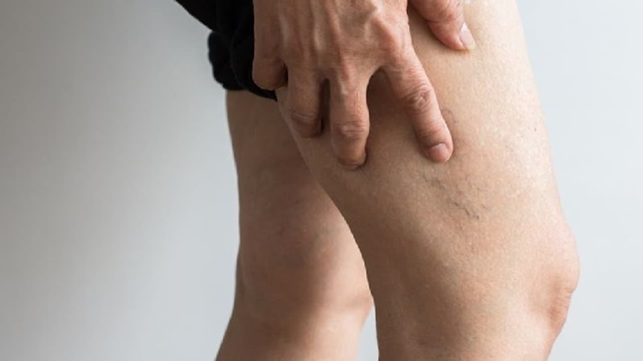 Covid 19 After effects : കൊവിഡിന് ശേഷം മാസങ്ങളോളം ശ്രദ്ധിക്കേണ്ട ഗൗരവതരമായ പ്രശ്‌നം