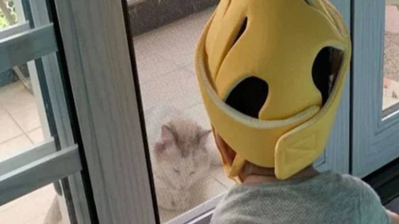 കുഞ്ഞുങ്ങളുടെ തല വൃത്താകൃതിയിലാക്കാൻ ചൈനയിൽ മാതാപിതാക്കൾ ഹെൽമറ്റ് ധരിപ്പിക്കുന്നുവെന്ന് റിപ്പോർട്ട് കുഞ്ഞുങ്ങളുടെ തല വൃത്താകൃതിയിലാക്കാൻ ചൈനയിൽ മാതാപിതാക്കൾ ഹെൽമറ്റ് ധരിപ്പിക്കുന്നുവെന്ന് റിപ്പോർട്ട്