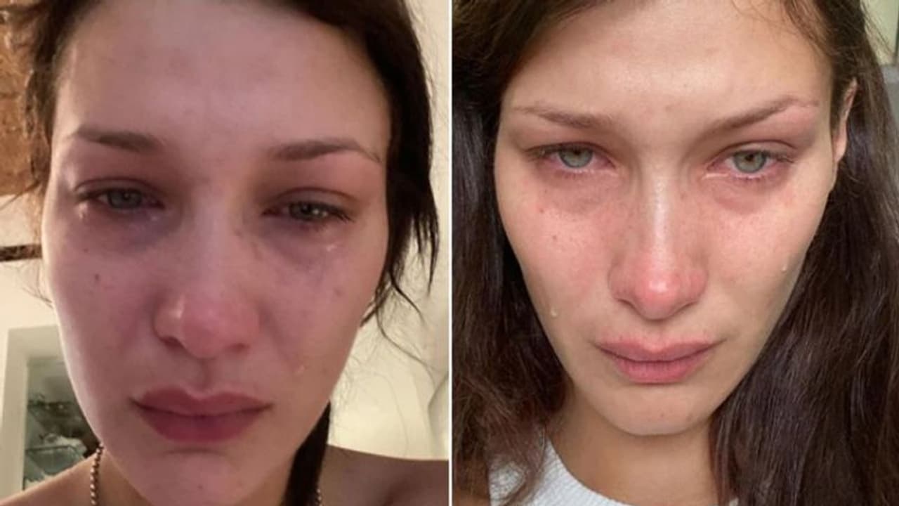 Depression| കരച്ചില്‍ സെല്‍ഫികള്‍ ഇന്‍സ്റ്റഗ്രാമില്‍ പോസ്റ്റ് ചെയ്ത് അമേരിക്കന്‍ മോഡല്‍