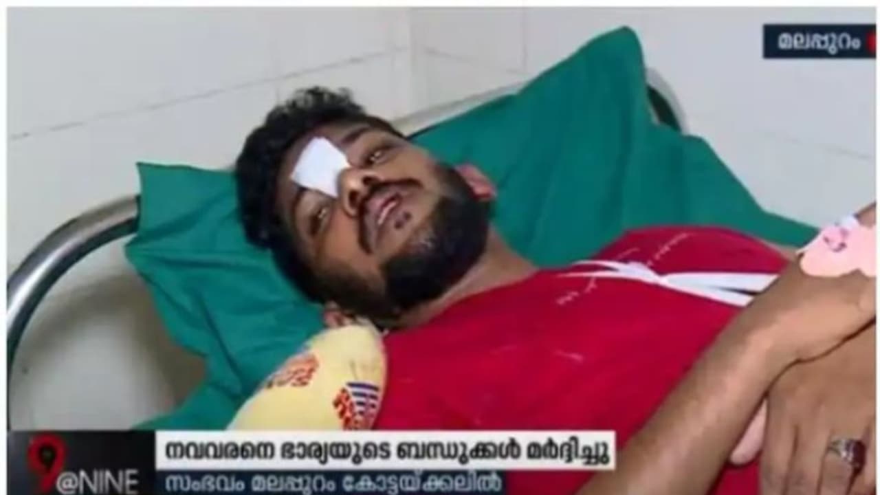 നവവരനെ തട്ടികൊണ്ടു പോയി മർദിച്ച കേസിൽ ഒളിവിലുള്ള ആളെ കണ്ടെത്താൻ അന്വേഷണം ഊർജിതമാക്കി പൊലീസ് നവവരനെ തട്ടികൊണ്ടു പോയി മർദിച്ച കേസിൽ ഒളിവിലുള്ള ആളെ കണ്ടെത്താൻ അന്വേഷണം ഊർജിതമാക്കി പൊലീസ്