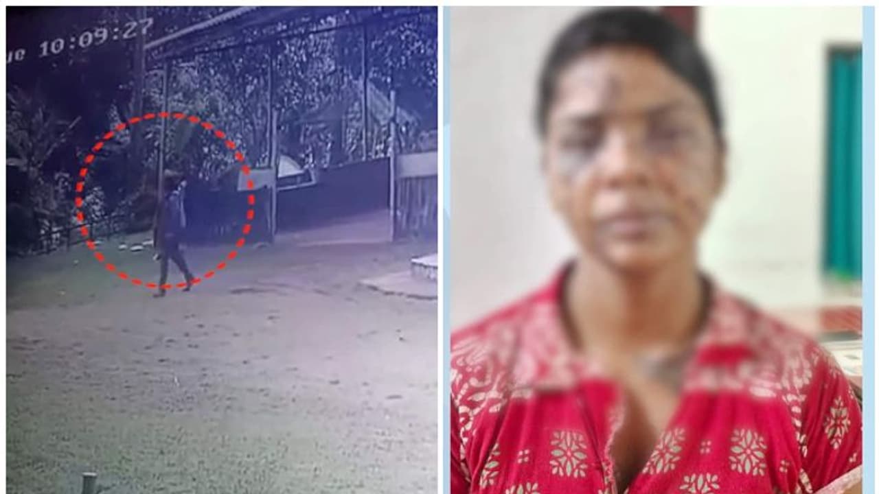 മുഖത്തെ പൊള്ളല് കഞ്ഞിവെള്ളം വീണത്, ഭര്തൃവീട്ടില് ഒളിവില് കഴിയുമ്പോള് സംശയത്തിനിട നല്കാതെ വീട്ടമ്മ മുഖത്തെ പൊള്ളല് കഞ്ഞിവെള്ളം വീണത്, ഭര്തൃവീട്ടില് ഒളിവില് കഴിയുമ്പോള് സംശയത്തിനിട നല്കാതെ വീട്ടമ്മ