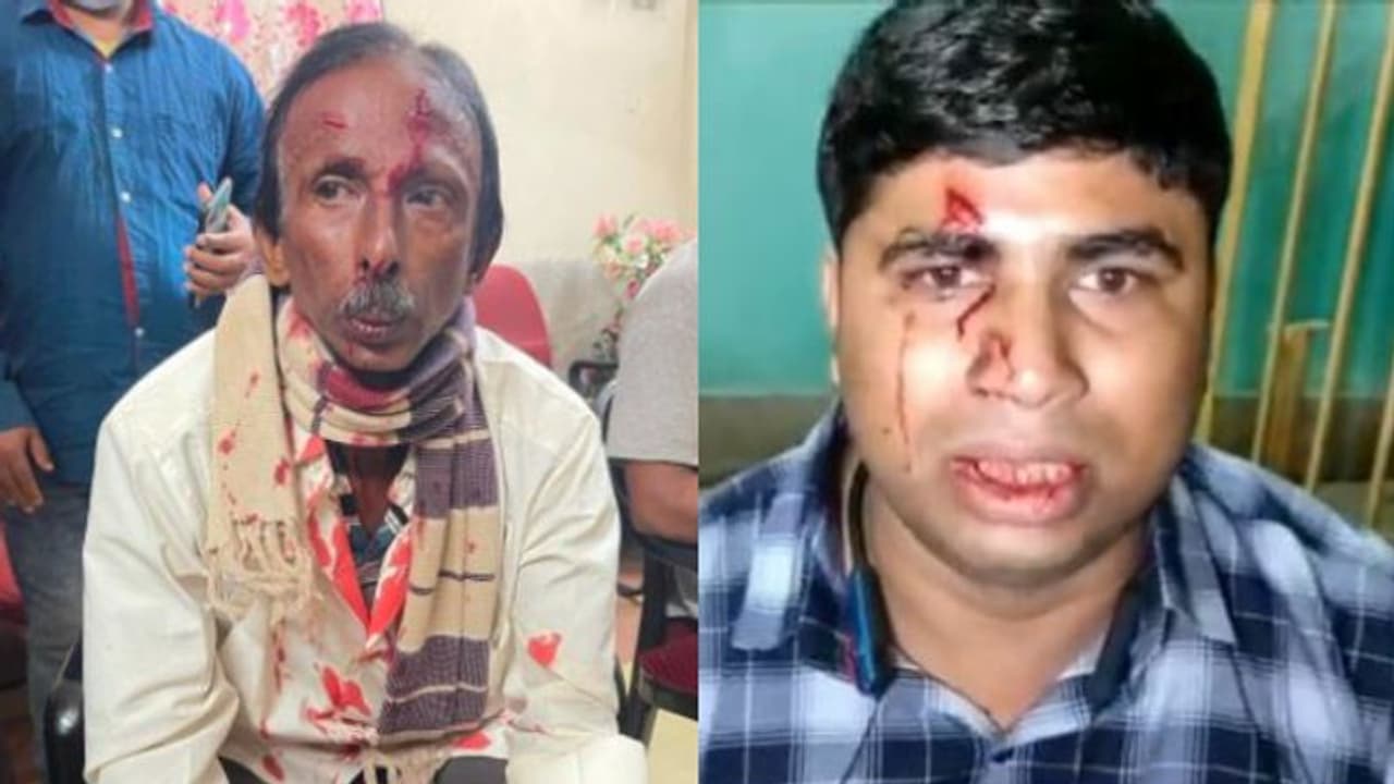 Tripura এবার ত্রিপুরাতে রক্ত ঝরল সাংবাদিকের, ফের আক্রান্ত তৃণমূলও Tripura এবার ত্রিপুরাতে রক্ত ঝরল সাংবাদিকের, ফের আক্রান্ত তৃণমূলও