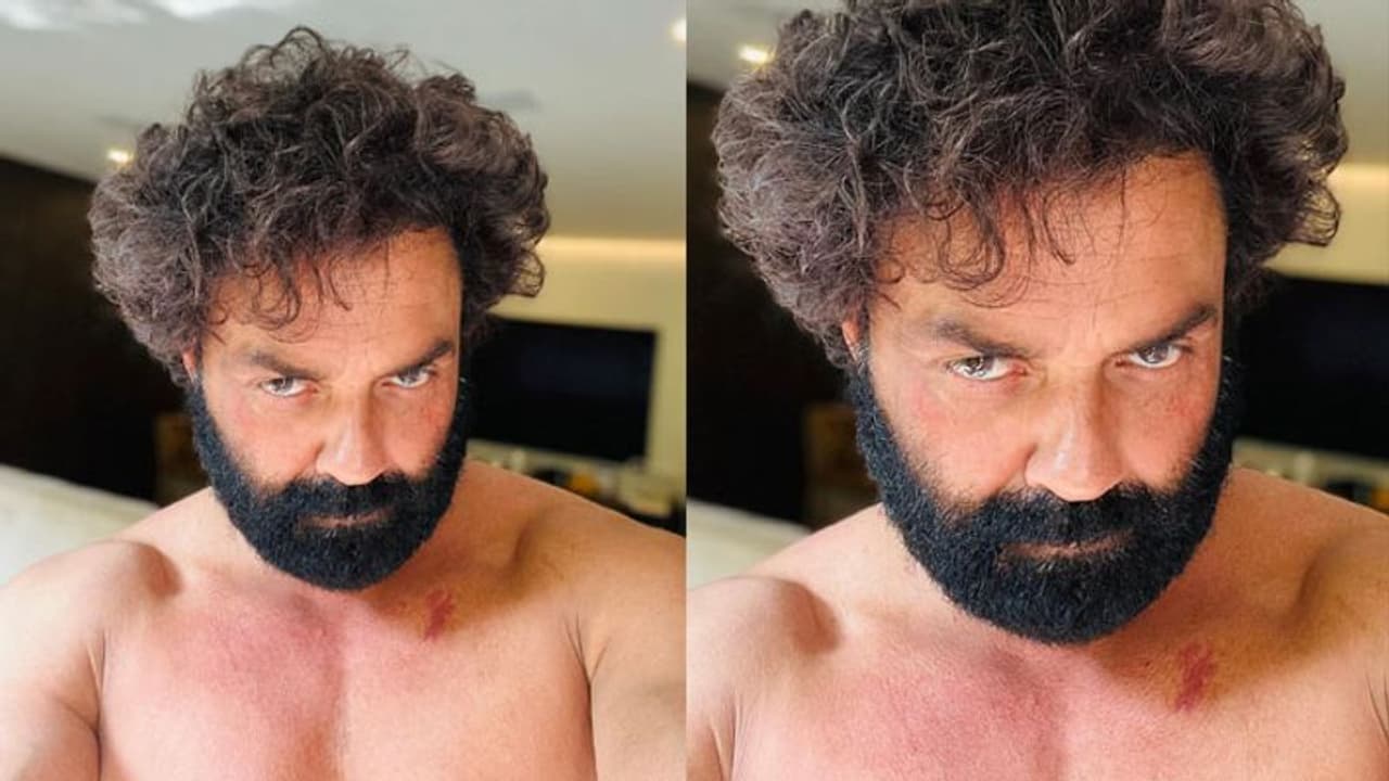 बढ़ी दाढ़ी, चेहरे पर गुस्सा और बिना कपड़ों के दिखे Bobby Deol, गले पर एक निशान देख उठे ऐसे सवाल बढ़ी दाढ़ी, चेहरे पर गुस्सा और बिना कपड़ों के दिखे Bobby Deol, गले पर एक निशान देख उठे ऐसे सवाल