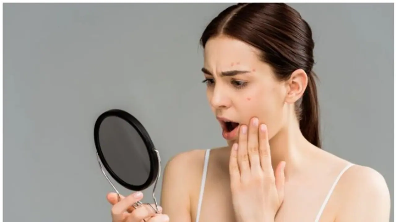 Oily Skin : എണ്ണമയമുള്ള ചർമ്മമുള്ളവർ ശ്രദ്ധിക്കേണ്ട നാല് കാര്യങ്ങൾ