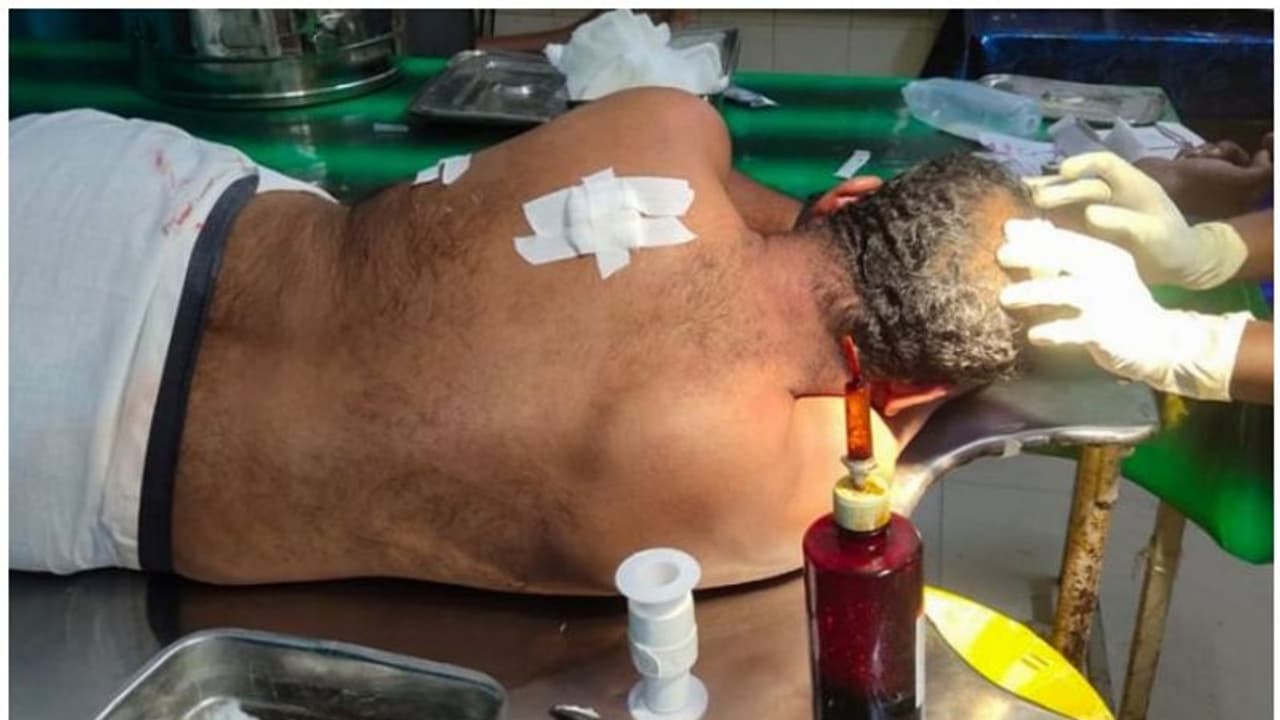 വിവാഹ ഹാളില്‍ മകളെ ശല്ല്യം ചെയ്തു; ചോദ്യം ചെയ്ത അച്ഛനെ യുവാവും സംഘവും കുത്തിപ്പരിക്കേല്‍പ്പിച്ചു