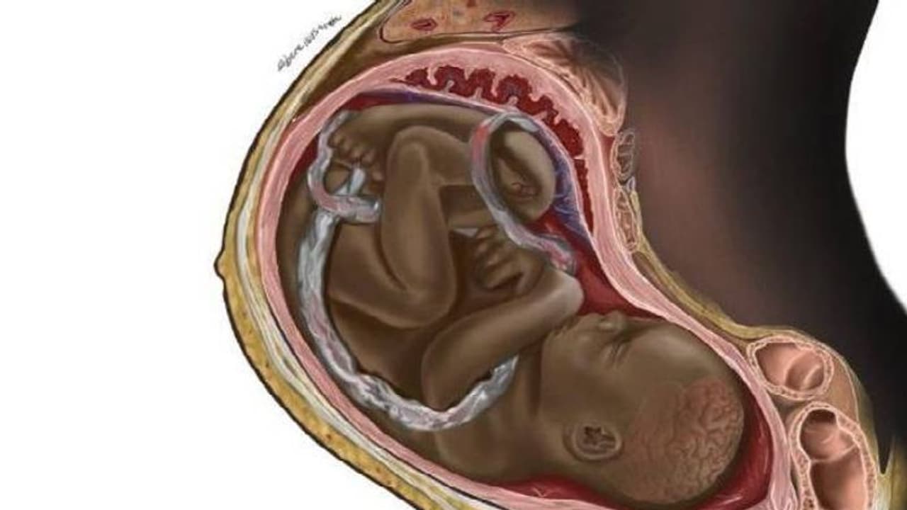 Black Fetus : ഗർഭസ്ഥശിശുവിന് കറുത്ത നിറം​? വൈറലായി ചിത്രം, ഇതുവരെ ഇങ്ങനെയൊന്ന് കണ്ടിട്ടില്ലെന്ന് സോഷ്യല്‍മീഡിയ