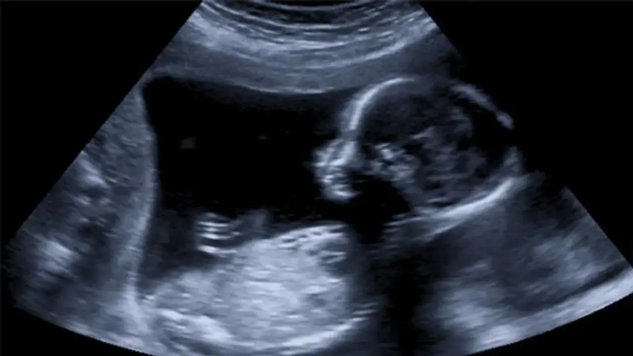 ಮಗಳನ್ನೇ ರೇಪ್ ಮಾಡಿದ ತಂದೆ, 10ರ ಬಾಲಕಿಯ ಅಬಾರ್ಷನ್ಗೆ ಅನುಮತಿ ಕೊಟ್ಟ ಕೋರ್ಟ್! ಮಗಳನ್ನೇ ರೇಪ್ ಮಾಡಿದ ತಂದೆ, 10ರ ಬಾಲಕಿಯ ಅಬಾರ್ಷನ್ಗೆ ಅನುಮತಿ ಕೊಟ್ಟ ಕೋರ್ಟ್!