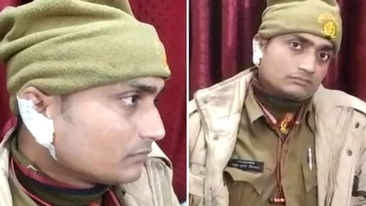 लखनऊ: दो पक्षों का विवाद सुलझाने पहुंची पुलिस, दबंगों ने सिपाही का काटा कान, आरोपियों की तलाश में जुटी पुलिस लखनऊ: दो पक्षों का विवाद सुलझाने पहुंची पुलिस, दबंगों ने सिपाही का काटा कान, आरोपियों की तलाश में जुटी पुलिस