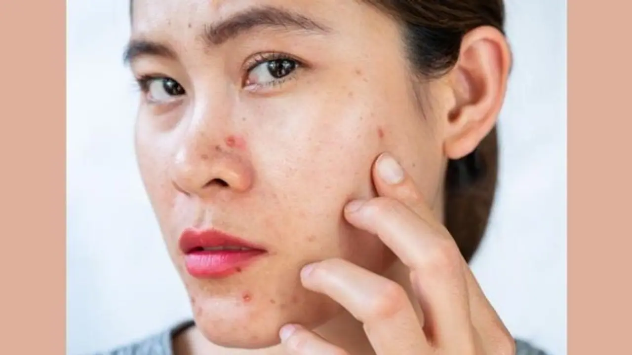 Skin Problem: प्रेगनेंसी के दौरान अगर आप भी हैं स्किन की प्रॉब्लम से परेशान, तो ऐसे रखें अपना ध्यान Skin Problem: प्रेगनेंसी के दौरान अगर आप भी हैं स्किन की प्रॉब्लम से परेशान, तो ऐसे रखें अपना ध्यान