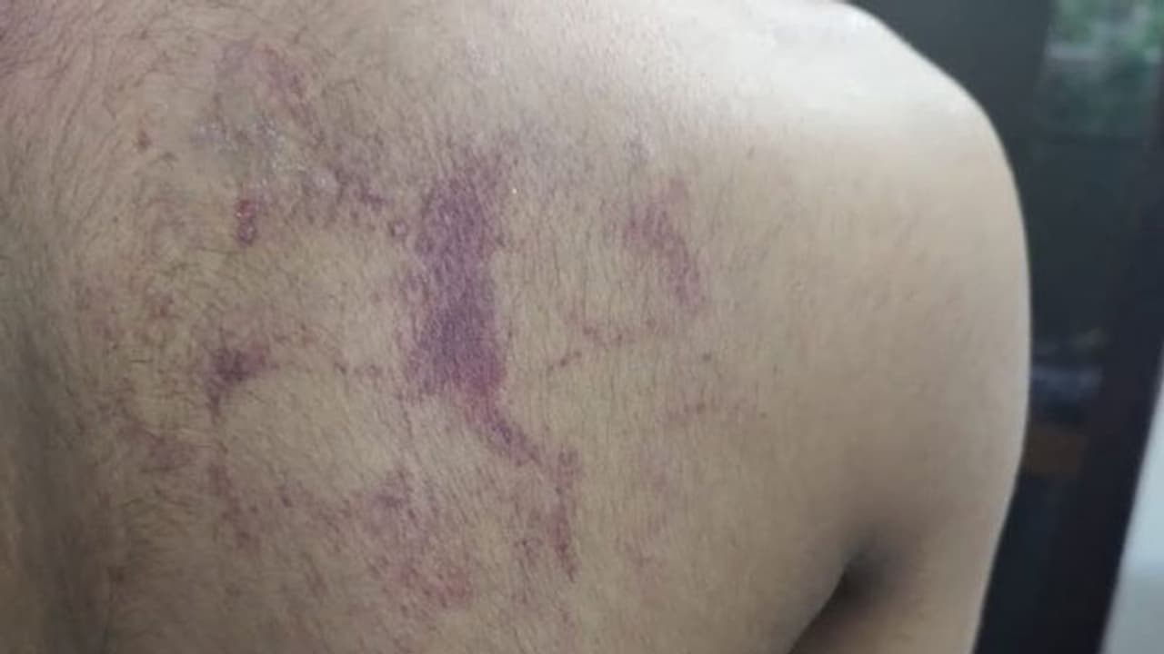 யூனிபார்ம் டைட்டா போட்டுவந்ததால் ஆத்திரம்.. கண்முன் தெரியாமல் போட்டு அடித்த ஆசிரியர்.. யூனிபார்ம் டைட்டா போட்டுவந்ததால் ஆத்திரம்.. கண்முன் தெரியாமல் போட்டு அடித்த ஆசிரியர்..