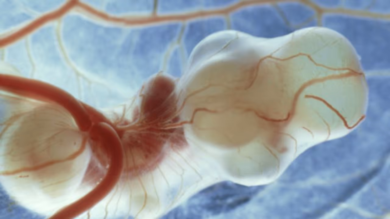 पेट में नहीं बल्कि लिवर में पल रहा बच्चा, ऐसा केस देख डॉक्टर रह गए दंग, बताई इसके पीछे की वजह?