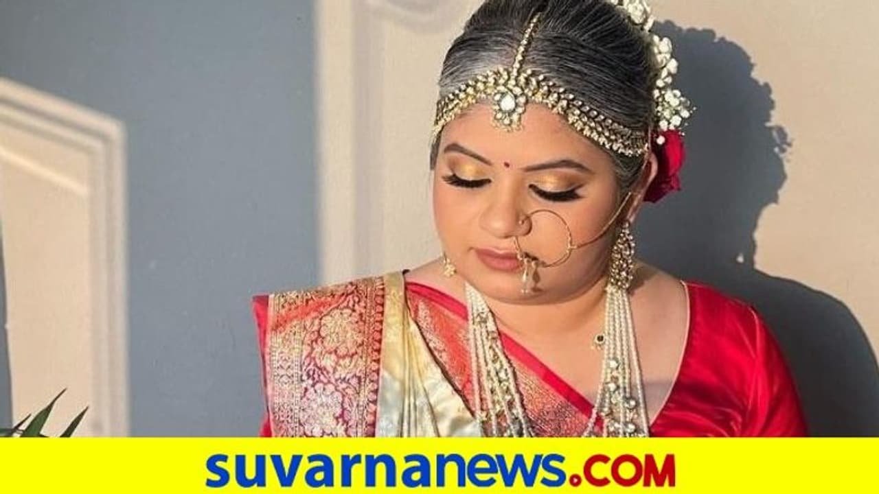 Bold Bride: ಬಿಳಿಕೂದಲಿನಲ್ಲಿಯೇ ಹಸೆಮಣೆಯೇರಿದ ಮದುಮಗಳು..! Bold Bride: ಬಿಳಿಕೂದಲಿನಲ್ಲಿಯೇ ಹಸೆಮಣೆಯೇರಿದ ಮದುಮಗಳು..!